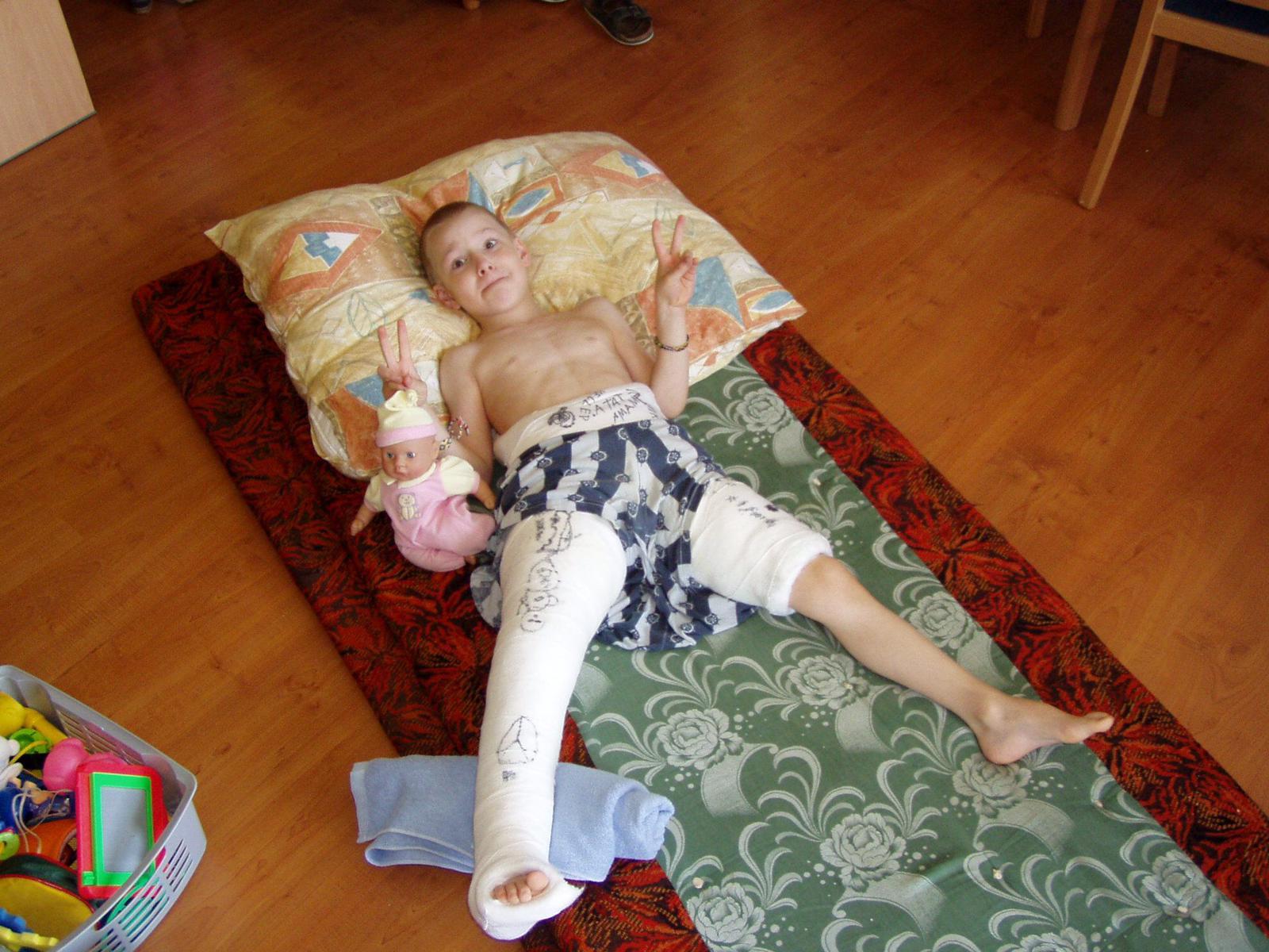 mladý Adam Kubík leží na zádech a má sádru na obou nohách, jednu přes celu nohu, a jednu od kolene výš